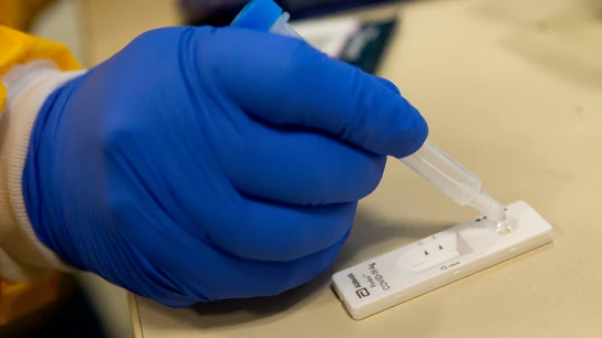 Bulo test de antígenos Bulo test de antígenos