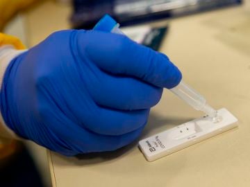 Bulo test de ant&iacute;genos