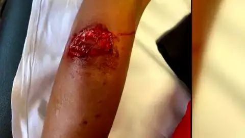 Un joven herido por una mordedura de perro Un joven herido por una mordedura de perro