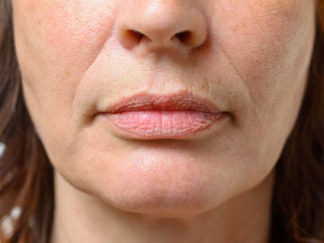 Arrugas naturales en el labio superior
