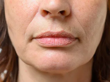 Arrugas naturales en el labio superior Arrugas naturales en el labio superior