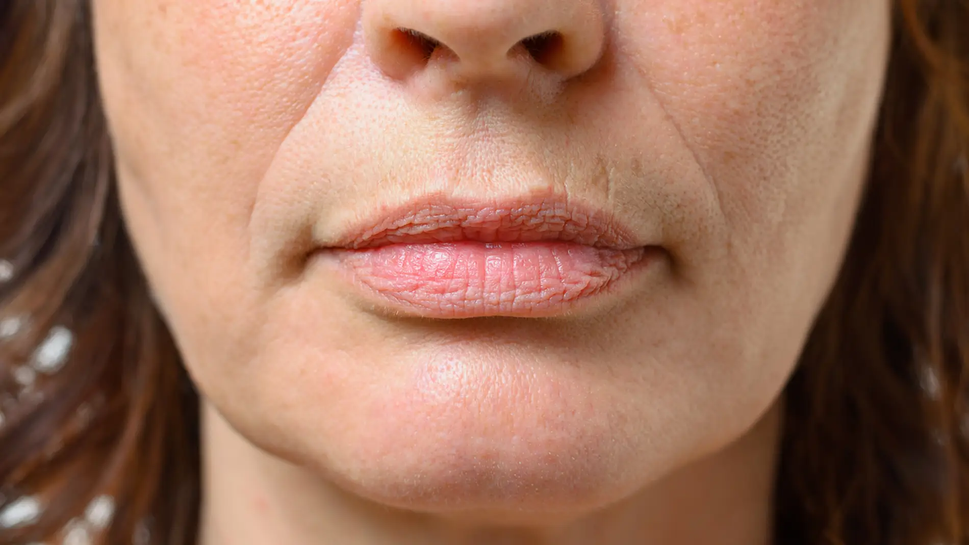 Arrugas naturales en el labio superior