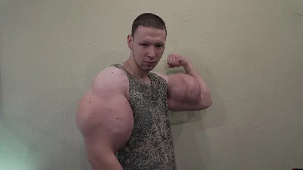 Los brazos del 'Popeye ruso' revientan durante un combate de la MMA