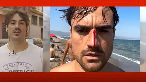 Agresión homófoba. Agresión homófoba.