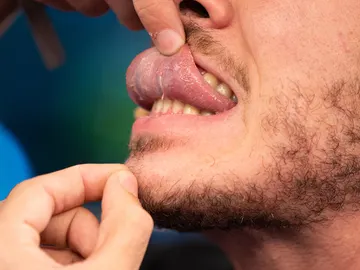 Marron muestra en 'El Hormiguero 3.0' una parte desconocida de tu cuerpo: la 'plica fimbriata' Marron muestra en 'El Hormiguero 3.0' una parte desconocida de tu cuerpo: la 'plica fimbriata'