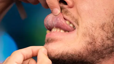 Marron muestra en 'El Hormiguero 3.0' una parte desconocida de tu cuerpo: la 'plica fimbriata' Marron muestra en 'El Hormiguero 3.0' una parte desconocida de tu cuerpo: la 'plica fimbriata'