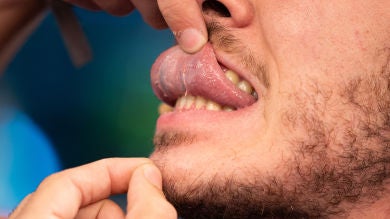 Marron muestra en 'El Hormiguero 3.0' una parte desconocida de tu cuerpo: la 'plica fimbriata'