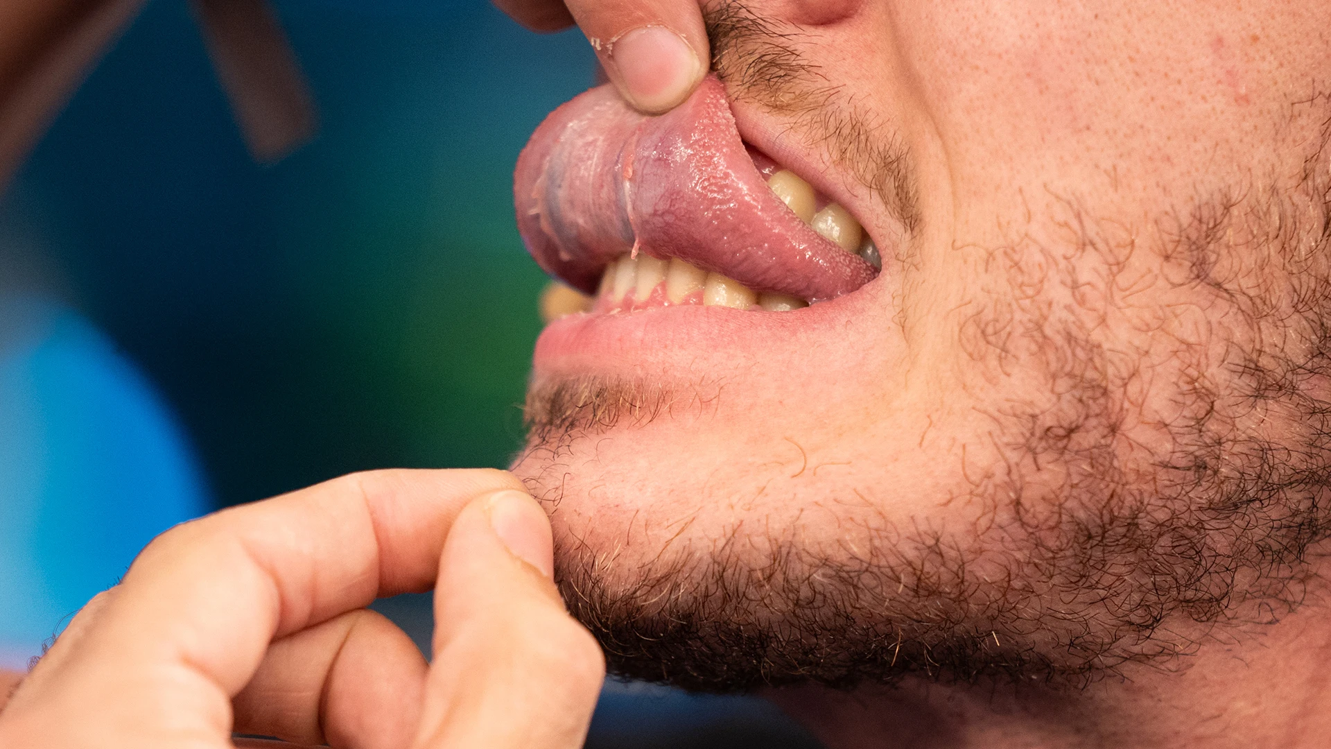 Marron muestra en 'El Hormiguero 3.0' una parte desconocida de tu cuerpo: la 'plica fimbriata' Marron muestra en 'El Hormiguero 3.0' una parte desconocida de tu cuerpo: la 'plica fimbriata'