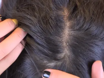 Los síntomas a los que debes prestar atención si no sabes que eres alérgico al tinte Los síntomas a los que debes prestar atención si no sabes que eres alérgico al tinte