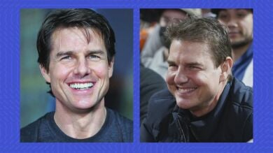 Ricky Martin y Tom Cruise... ¿Víctimas de desastres de la cirugía estética?