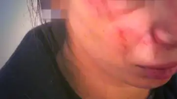 Agresión a una joven en Vitoria Agresión a una joven en Vitoria
