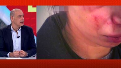 Investigan la paliza a una joven de 30 años como nuevo reto viral: 