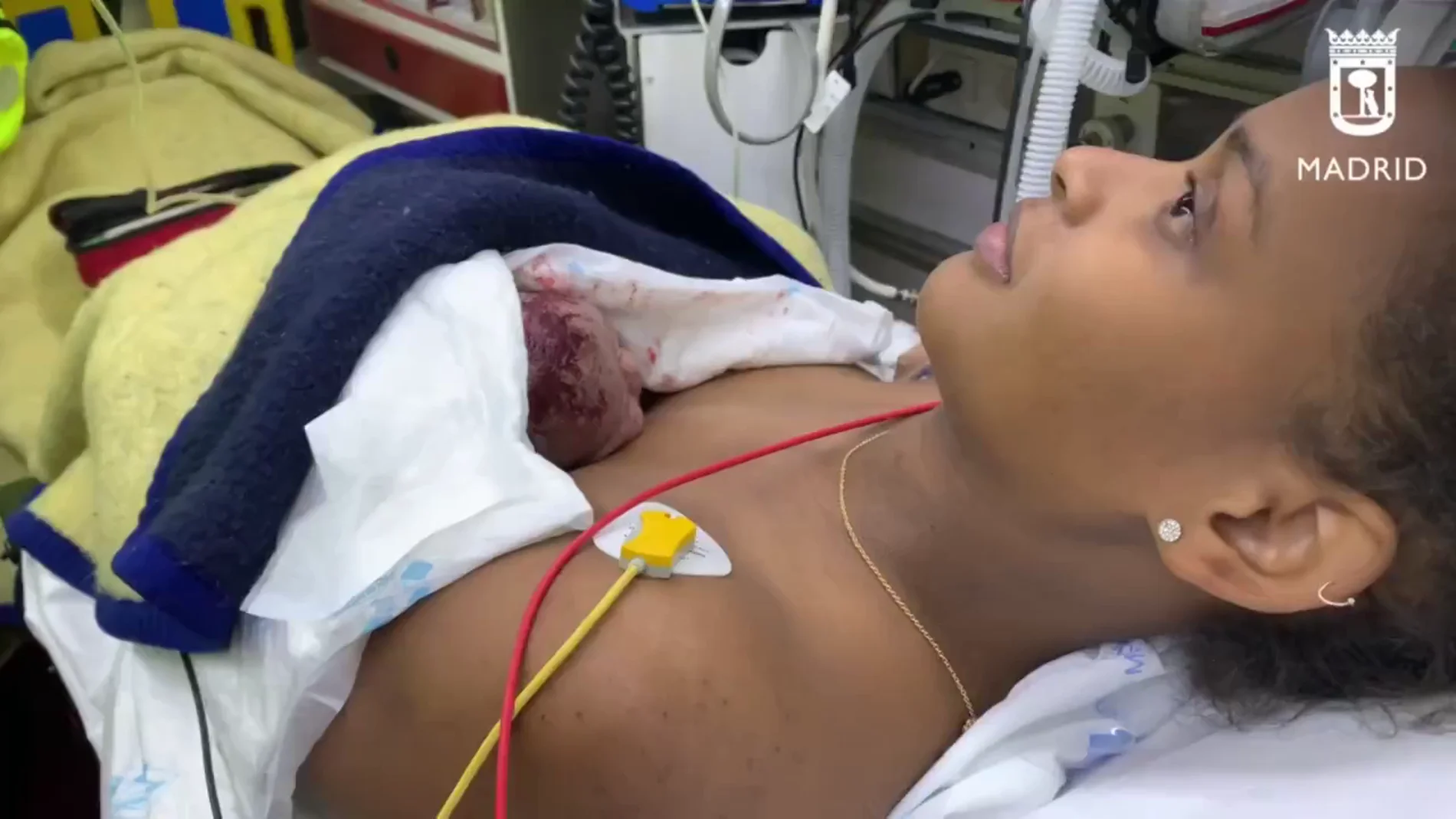 Una mujer de 26 años da a luz de camino al hospital con la ayuda de dos policías en Vallecas