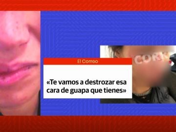 Agresi&oacute;n en Vitoria.
