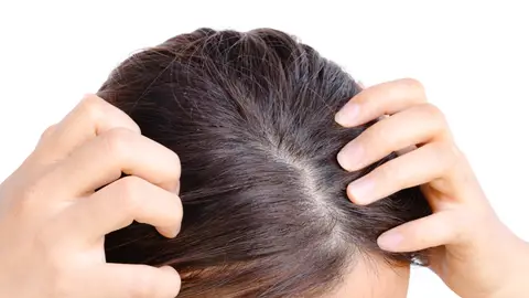 Cuero cabelludo Cuero cabelludo