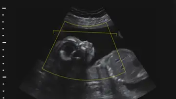 Demandan a una clínica de fertilidad por intercambiar por error los embriones de dos parejas Demandan a una clínica de fertilidad por intercambiar por error los embriones de dos parejas