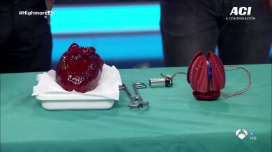 ¡Pelos de punta! Marron trae por primera vez a 'El Hormiguero 3.0' un corazón robótico 