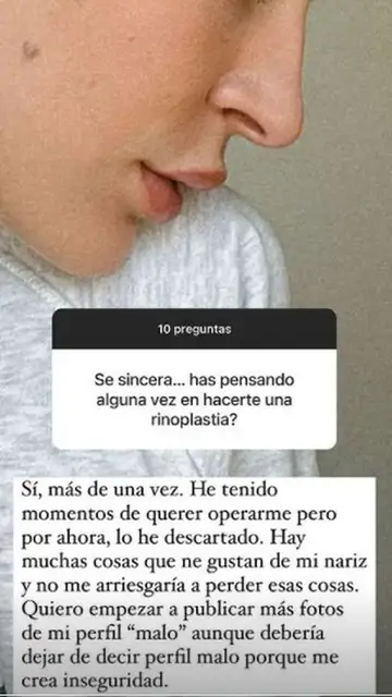 Laura Escanes confiesa que sí se ha planteado someterse a una rinoplastia Laura Escanes confiesa que sí se ha planteado someterse a una rinoplastia