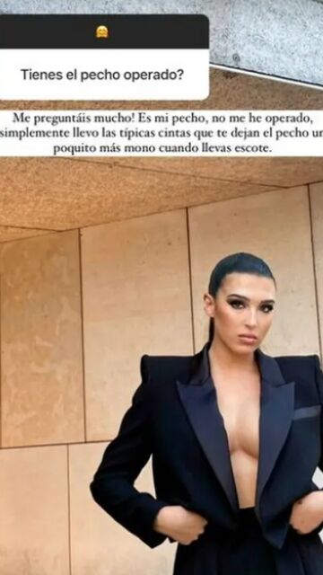 Alba Díaz aclara si se ha operado o no el pecho