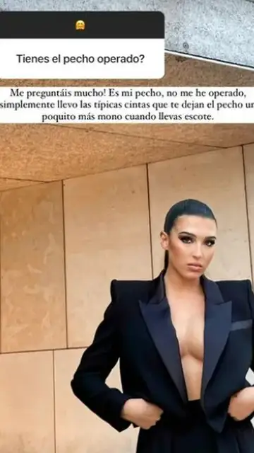 Alba Díaz aclara si se ha operado o no el pecho Alba Díaz aclara si se ha operado o no el pecho