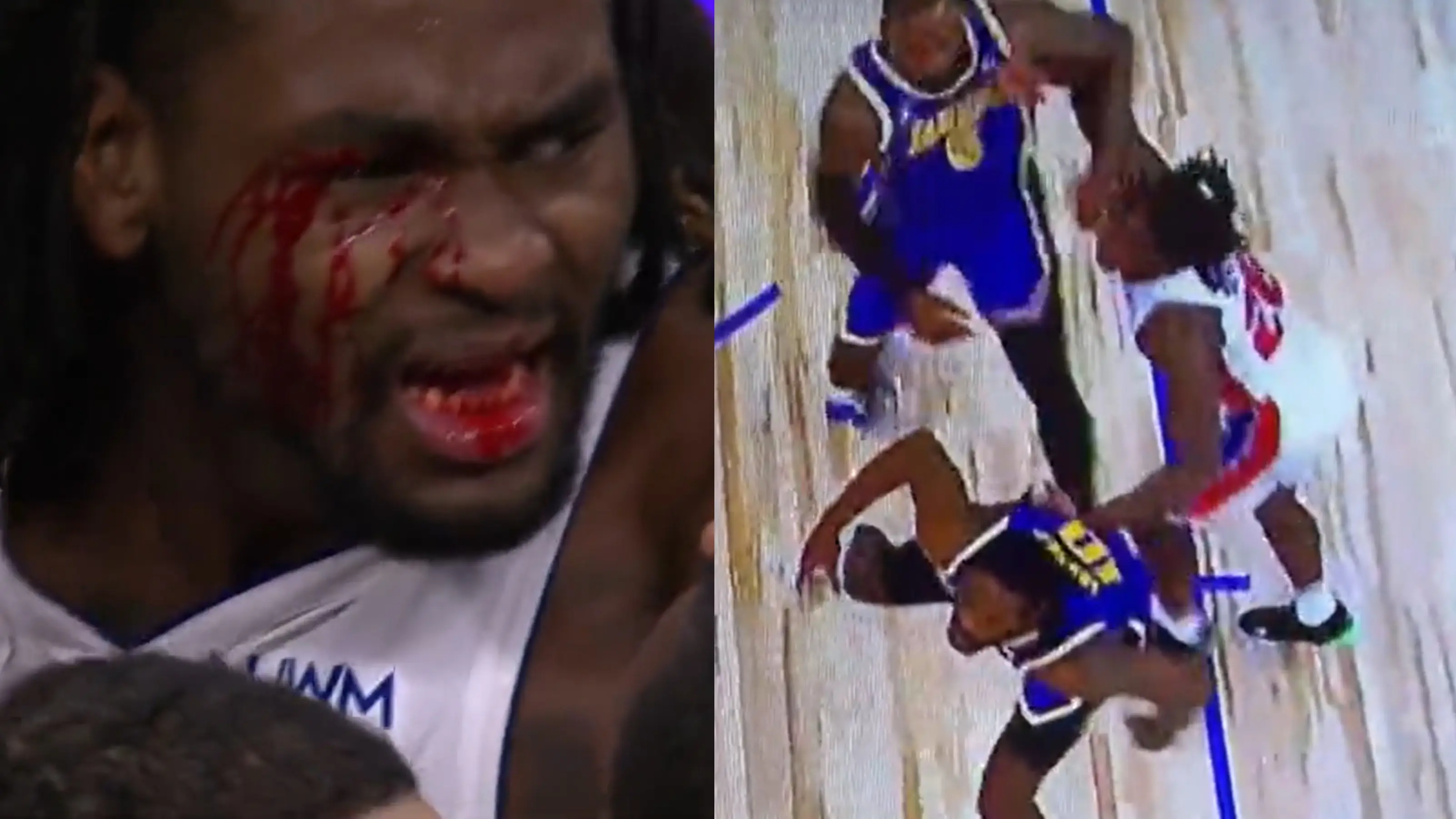 L&iacute;o monumental en la NBA por un codazo sangriengo de LeBron James a Isaiah Stewart