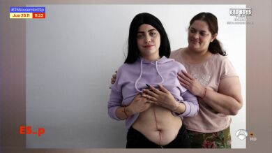 Apuñalada por su exnovio a los 18 años: 