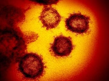 Una cepa del coronavirus, vista a nivel microscópico.
