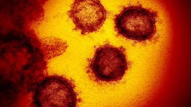 Una cepa del coronavirus, vista a nivel microsc&oacute;pico.