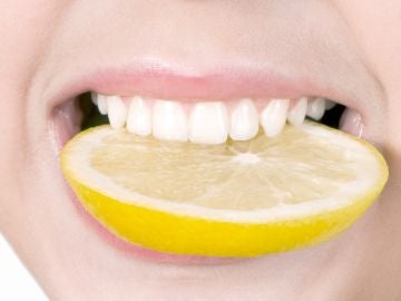 Los profesionales desaconsejan blanquear los dientes con limón.