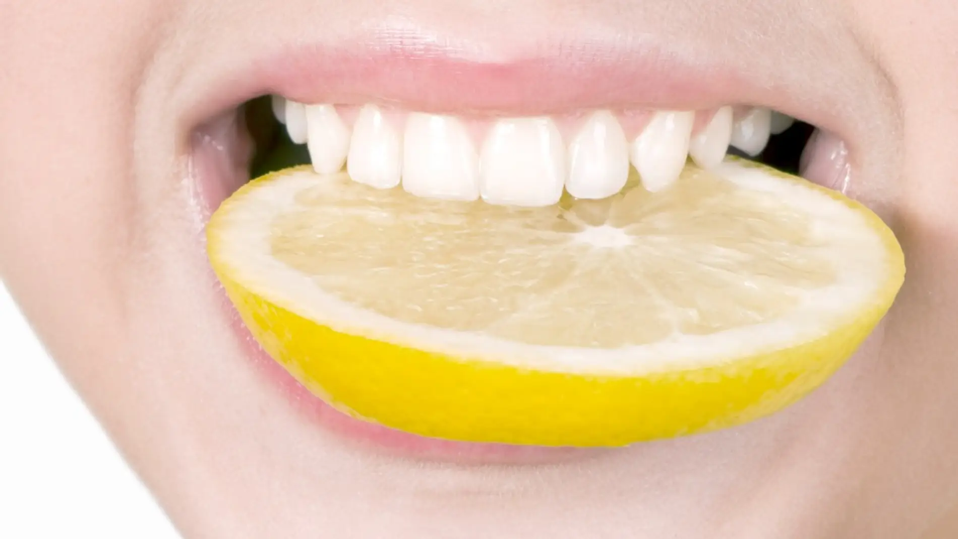 Los profesionales desaconsejan blanquear los dientes con limón.