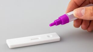 Test coronavirus en farmacias