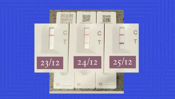 La doctora Marián García explica cómo interpretar un test de antígenos en casa y qué son los 'positivos tímidos' La doctora Marián García explica cómo interpretar un test de antígenos en casa y qué son los 'positivos tímidos'