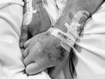 Los ancianos dados de la mano antes de morir Los ancianos dados de la mano antes de morir