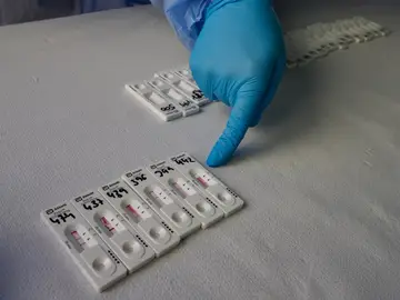 El precio de los test de antígenos