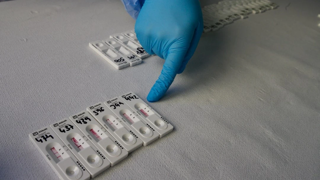 El precio de los test de antígenos El precio de los test de antígenos