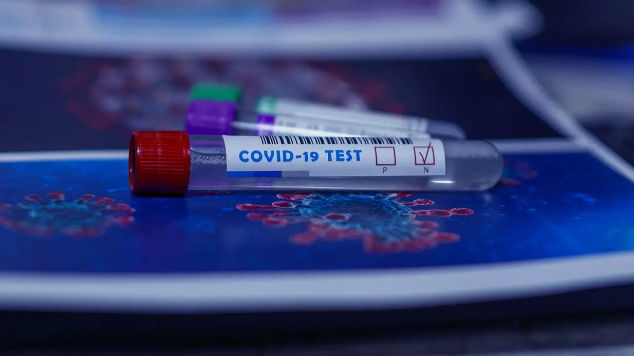 ¿Cuándo debo hacerme un test de antígenos si he estado en contacto con un positivo en coronavirus? ¿Cuándo debo hacerme un test de antígenos si he estado en contacto con un positivo en coronavirus?