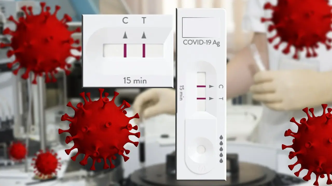 ¿Cuál es el significado de la T y la C de los test de antígenos? ¿Cuál es el significado de la T y la C de los test de antígenos?