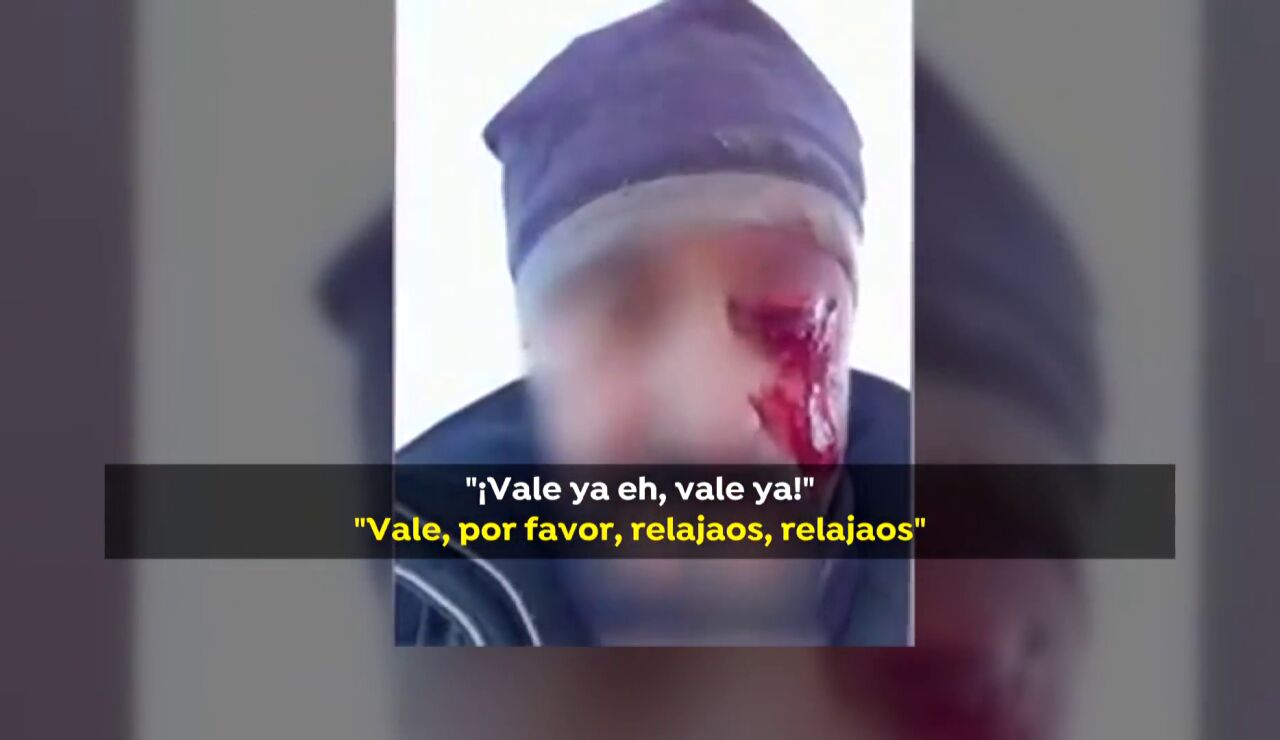 Un hombre pierde un ojo tras una pelea con dos cazadores en Toledo