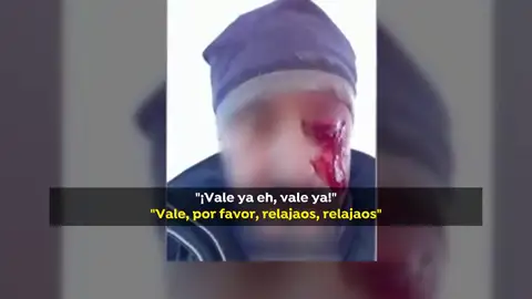 Un hombre pierde un ojo tras una pelea con dos cazadores en Toledo Un hombre pierde un ojo tras una pelea con dos cazadores en Toledo