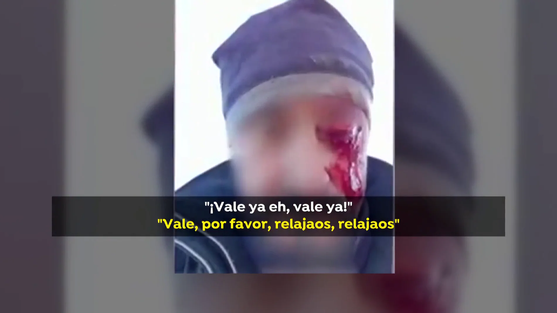 Un hombre pierde un ojo tras una pelea con dos cazadores en Toledo