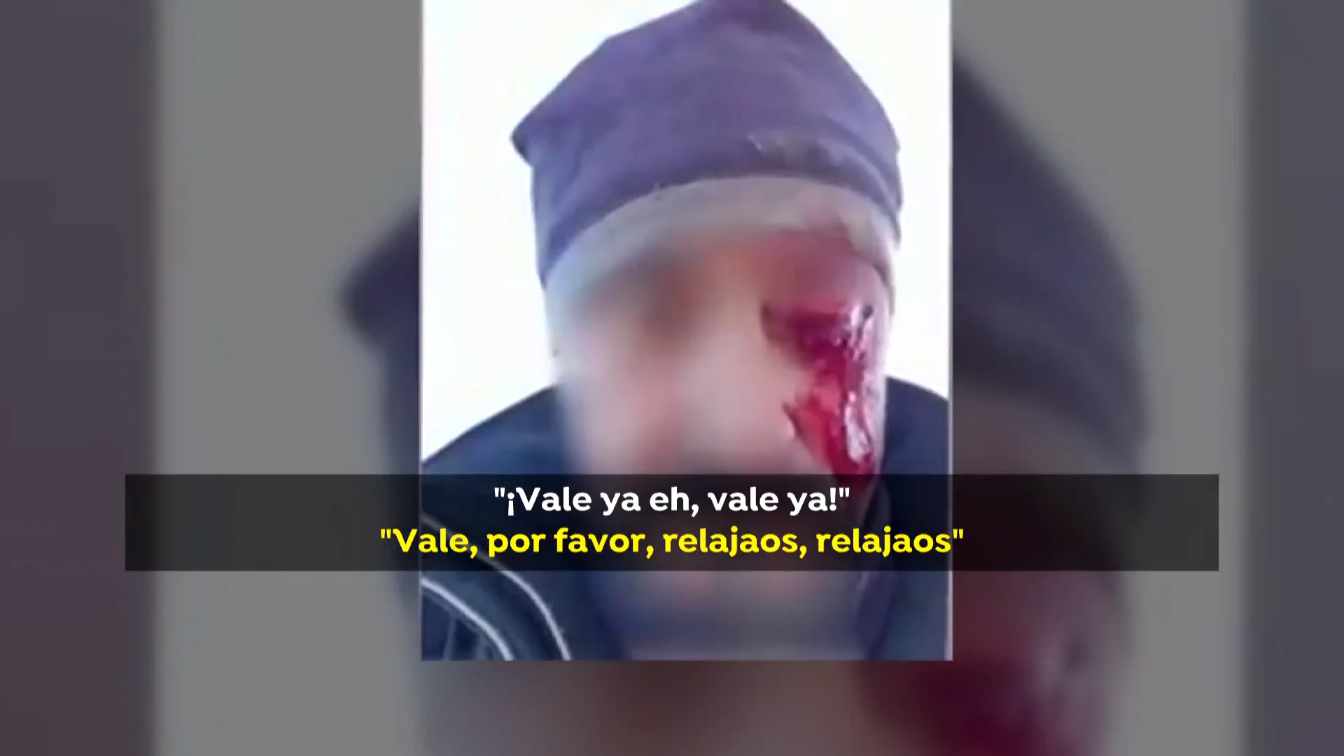 Un hombre pierde un ojo tras una pelea con dos cazadores en Toledo