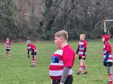 El mundo del rugby se vuelca con Alfie, un niño de 12 años objeto de mofas por su aspecto físico