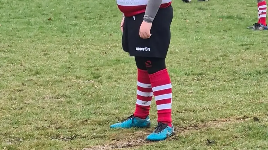 El mundo del rugby se vuelca con Alfie, un niño de 12 años objeto de mofas por su aspecto físico El mundo del rugby se vuelca con Alfie, un niño de 12 años objeto de mofas por su aspecto físico