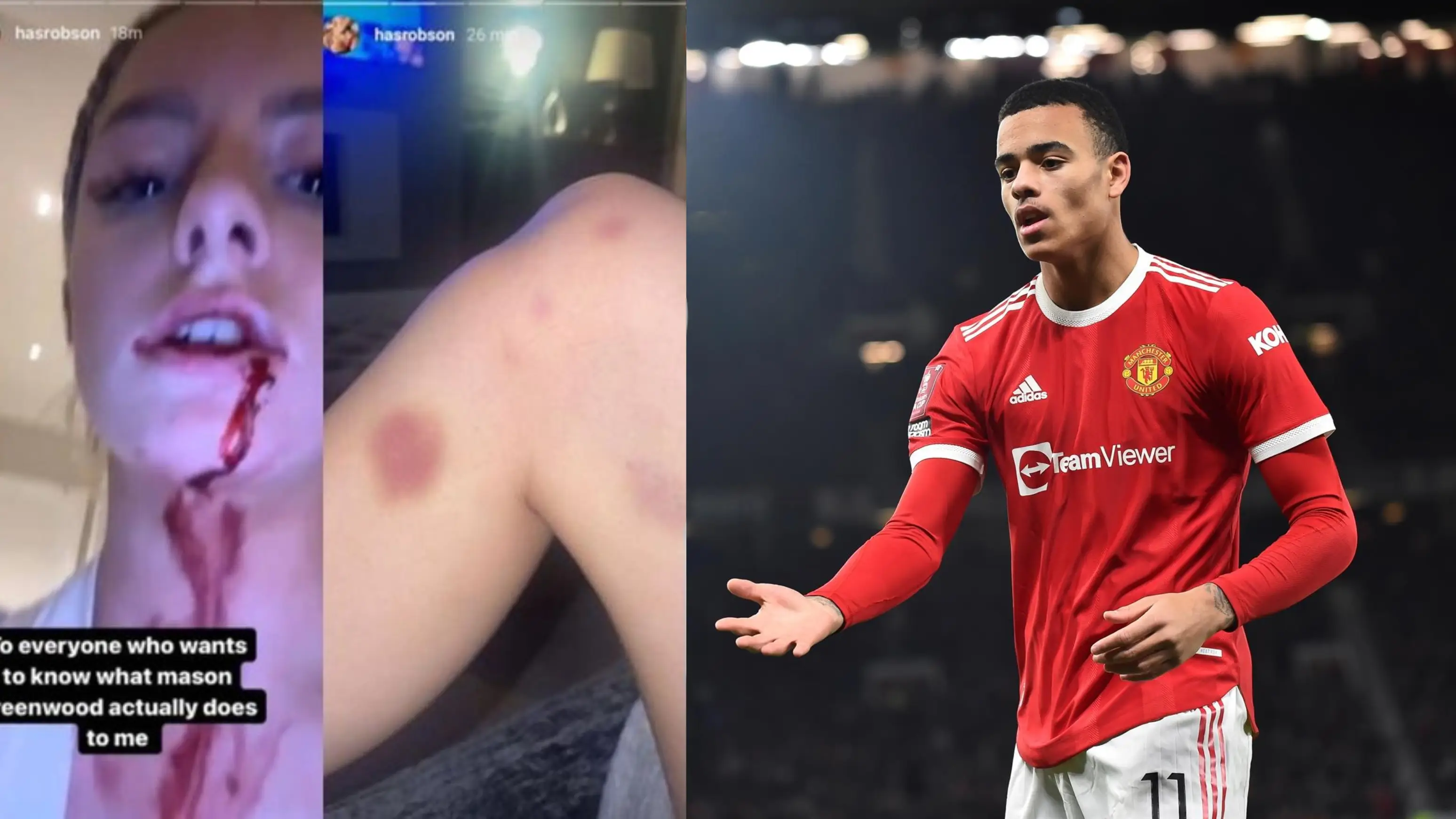 La im&aacute;genes de la pregunta agresi&oacute;n de Greenwood a su novia