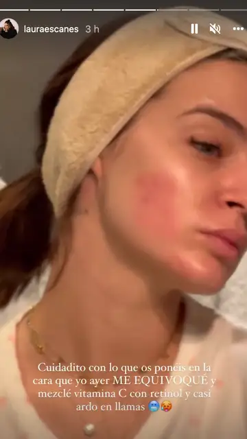 Piel de Laura Escanes Laura Escanes