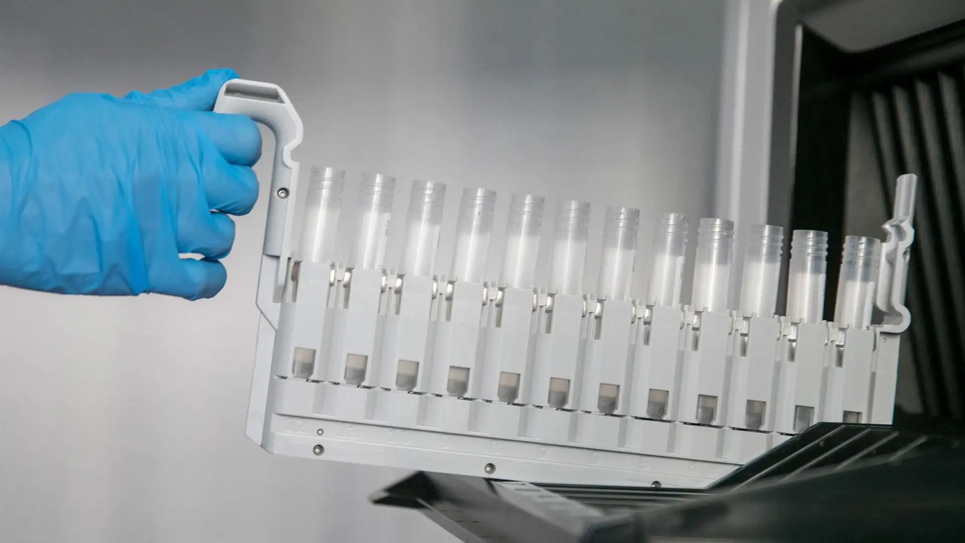 Un biomarcador es capaz de predecir la gravedad de la Covid-19