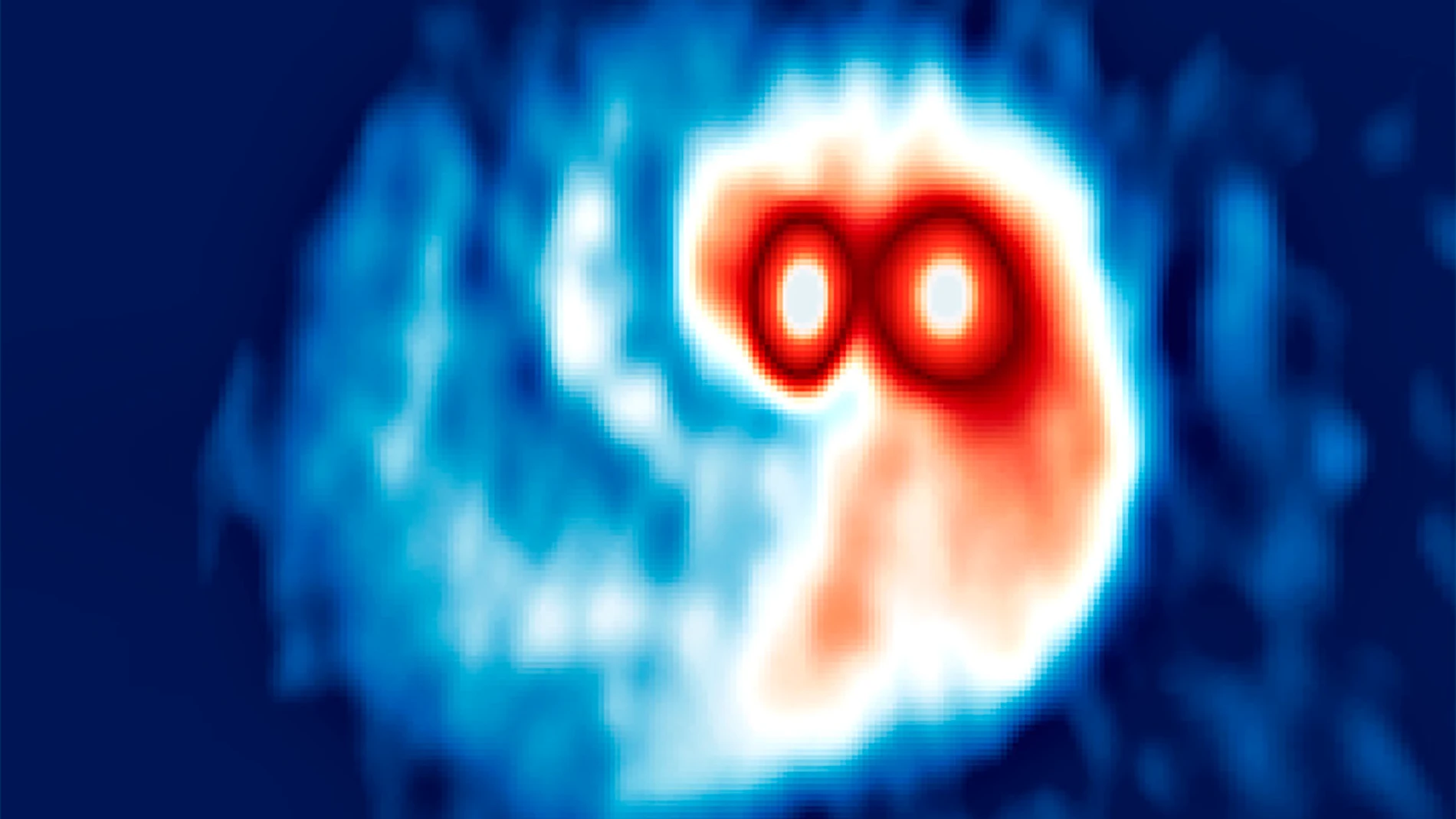Observaciones realizadas con el radiotelescopio ALMA de los discos de polvo alrededor de la estrella doble SVS13 Observaciones realizadas con el radiotelescopio ALMA de los discos de polvo alrededor de la estrella doble SVS13