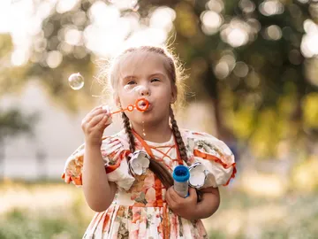 Síndrome de Down: Causas, tipos y características Síndrome de Down: Causas, tipos y características