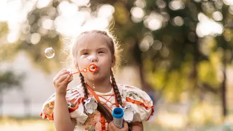 Síndrome de Down: Causas, tipos y características Síndrome de Down: Causas, tipos y características