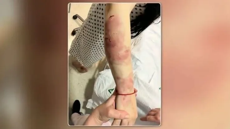 Paliza joven 17 años Paliza joven 17 años